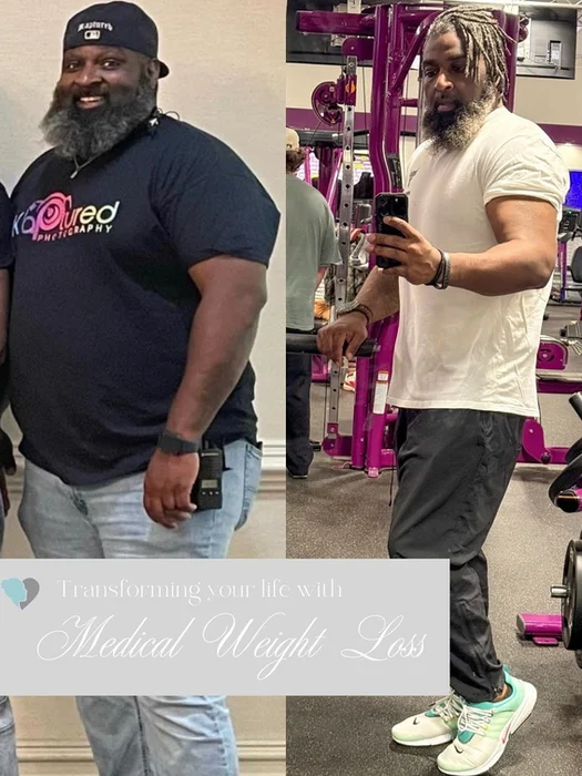 Medical weight loss results