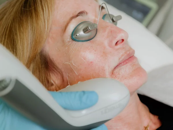Laser skin treatment at Northshore Skincare