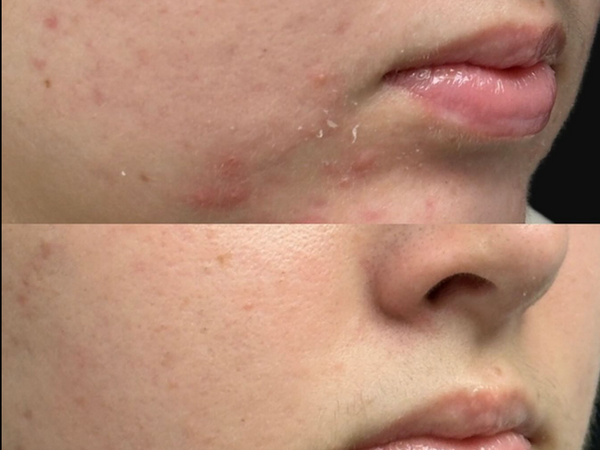 Diamond Glow at Northshore Skincare